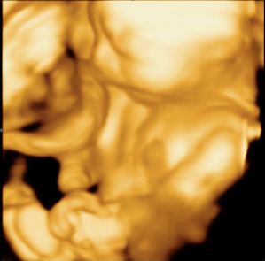 3d ultrasound pic